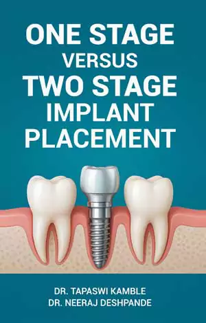 One Stage Versus Two Stage Implant Placement