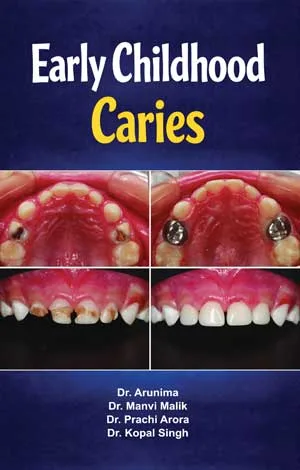 Early Childhood Caries