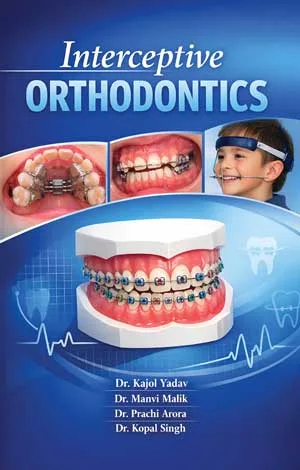 Interceptive Orthodontics