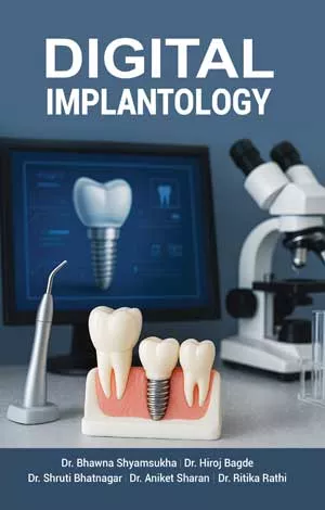 Digital Implantology